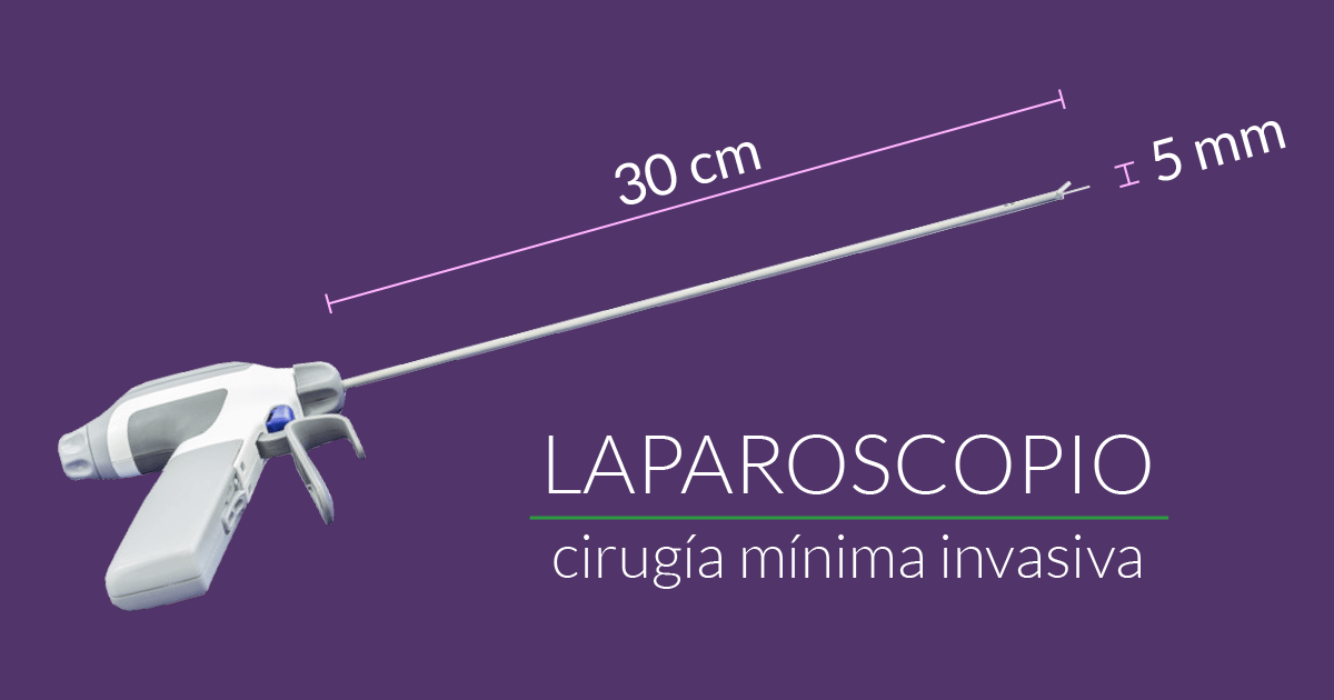 Laparoscopía