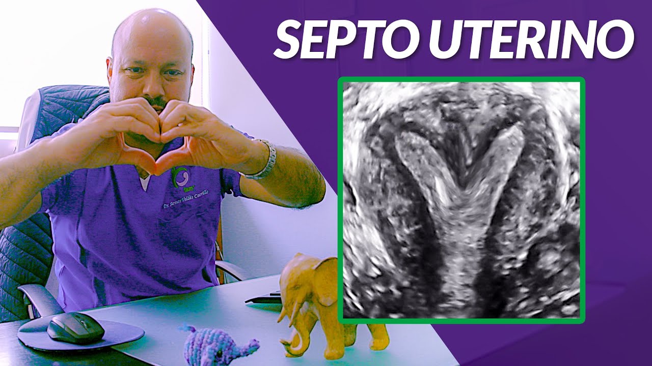Septo o tabique uterino malformaciones mulerianas