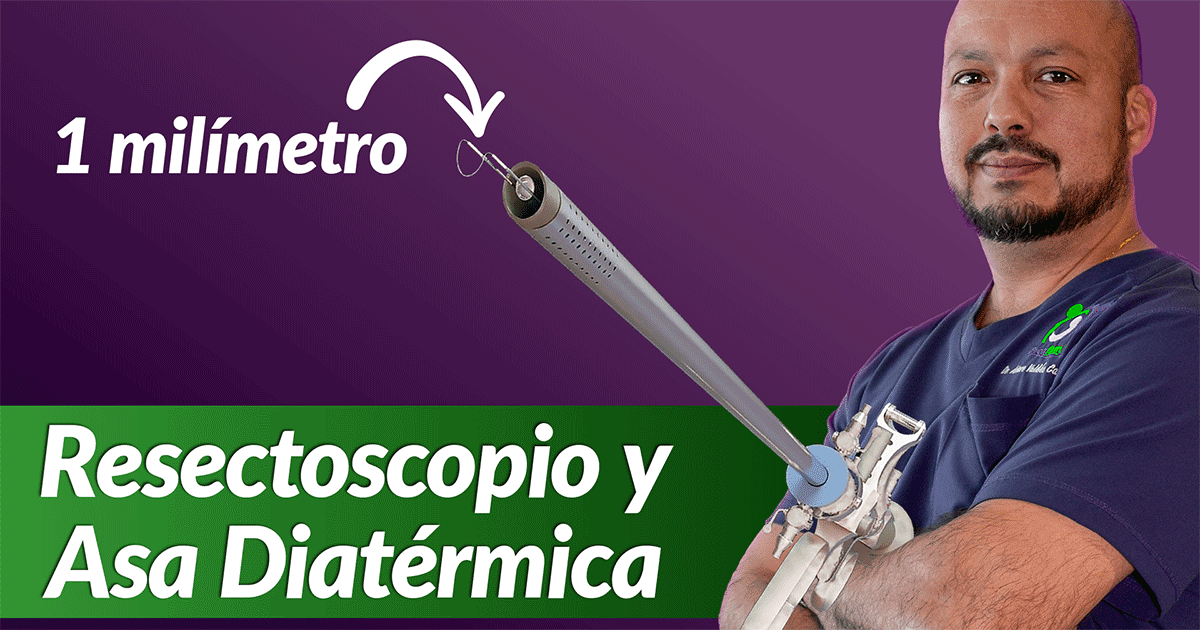 Resectoscopio y Asa Diatérmica Extracción Mioma Cirugía