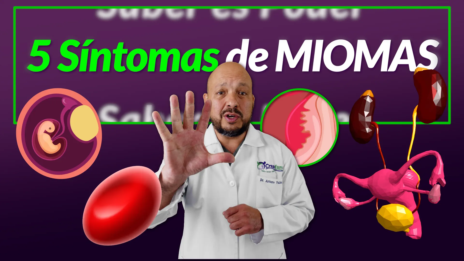 Síntomas Miomas. Sangrados, Abultamiento, Estreñimiento, Infertilidad, Anemia