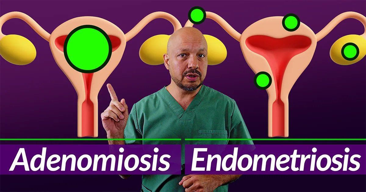 Endometriosis y adenomiosis, síntomas, cura, tratamiento, fertilidad e infertilidad